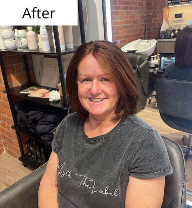 Lynette after bonded topper