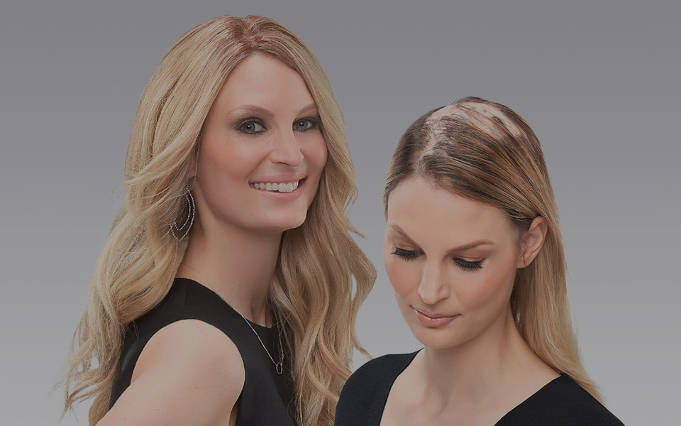 Hair Toppers for Hairloss