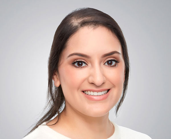 Understanding Hair Thinning and Receding Hairlines