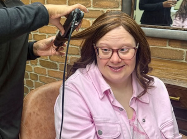 Understanding Hair Loss in Down Syndrome