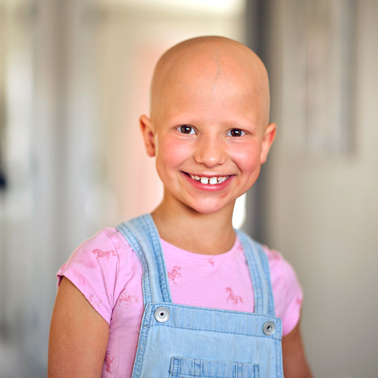 Smiling girl with alopecia
