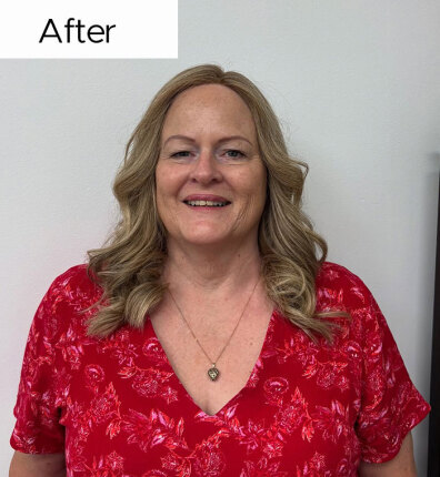 Kelly after bonded topper