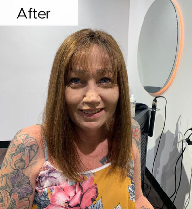 Sharlene after bonded topper