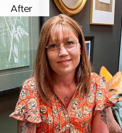 Sharlene after bonded topper