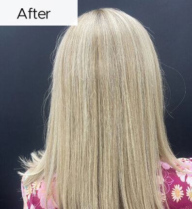 Tracey after bonded topper