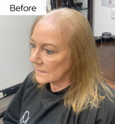 Tracey before bonded topper