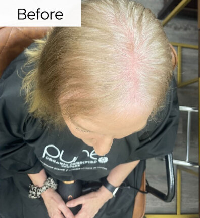 Tracey before bonded topper